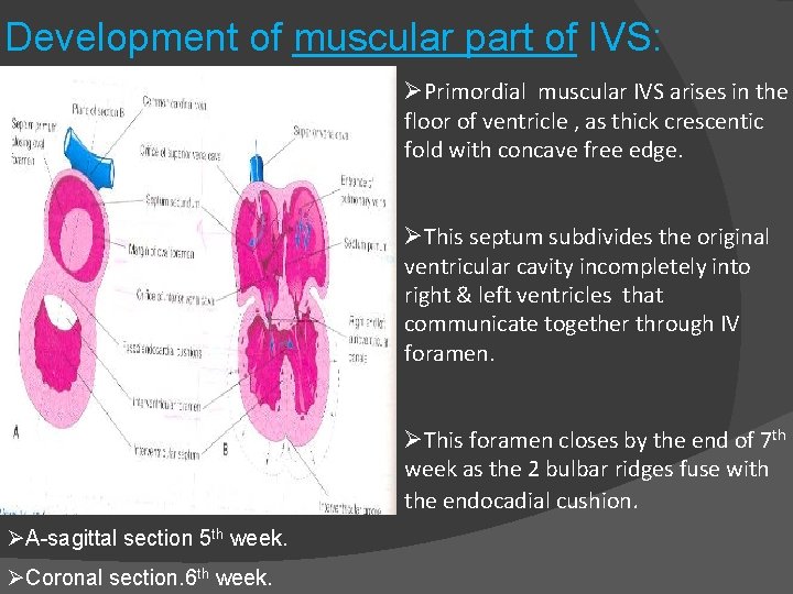 Development of muscular part of IVS: ØPrimordial muscular IVS arises in the floor of