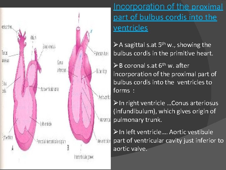 Incorporation of the proximal part of bulbus cordis into the ventricles ØA sagittal s.