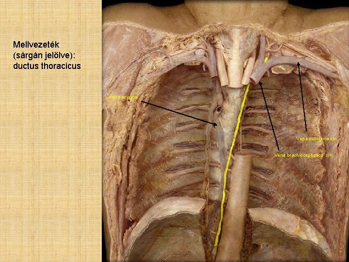 Mellvezeték (sárgán jelölve): ductus thoracicus Vena azygos Vena subclavia sin. Vena brachiocephalica sin. 