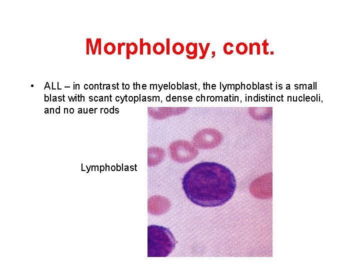 Morphology, cont. • ALL – in contrast to the myeloblast, the lymphoblast is a