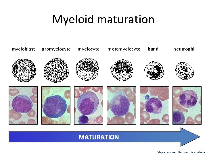 Myeloid maturation myeloblast promyelocyte metamyelocyte band neutrophil MATURATION Adapted and modified from U Va