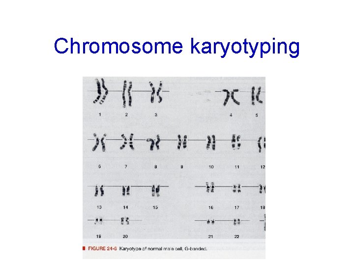 Chromosome karyotyping 