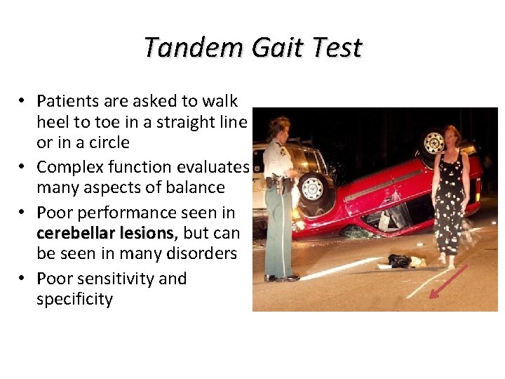 Tandem Gait Test • Patients are asked to walk heel to toe in a Tandem Gait Test • Patients are asked to walk heel to toe in a