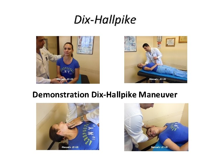 Dix-Hallpike Mercado 2013© Demonstration Dix-Hallpike Maneuver Mercado 2013© Dix-Hallpike Mercado 2013© Demonstration Dix-Hallpike Maneuver Mercado 2013©