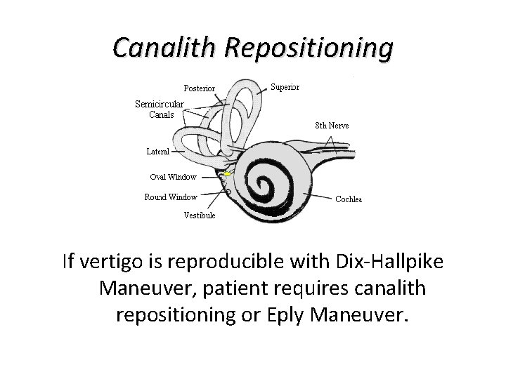 Canalith Repositioning If vertigo is reproducible with Dix-Hallpike Maneuver, patient requires canalith repositioning or Canalith Repositioning If vertigo is reproducible with Dix-Hallpike Maneuver, patient requires canalith repositioning or