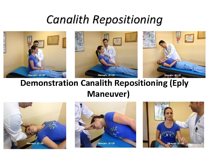 Canalith Repositioning Mercado 2013© Demonstration Canalith Repositioning (Eply Maneuver) Mercado 2013© Canalith Repositioning Mercado 2013© Demonstration Canalith Repositioning (Eply Maneuver) Mercado 2013©