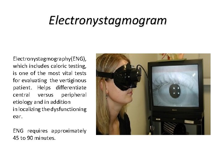 Electronystagmogram Electronystagmography (ENG), which includes caloric testing, is one of the most vital tests Electronystagmogram Electronystagmography (ENG), which includes caloric testing, is one of the most vital tests