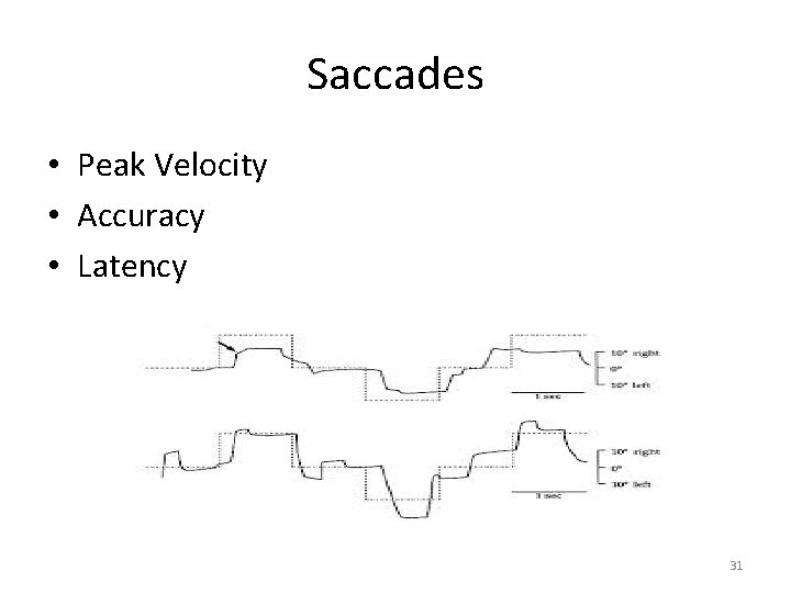 Saccades • Peak Velocity • Accuracy • Latency 31 Saccades • Peak Velocity • Accuracy • Latency 31