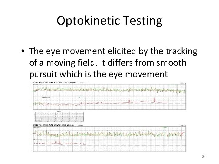 Optokinetic Testing • The eye movement elicited by the tracking of a moving field. Optokinetic Testing • The eye movement elicited by the tracking of a moving field.