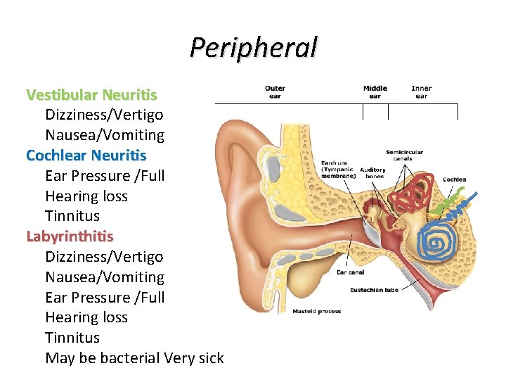 Peripheral Vestibular Neuritis Dizziness/Vertigo Nausea/Vomiting Cochlear Neuritis Ear Pressure /Full Hearing loss Tinnitus Labyrinthitis Peripheral Vestibular Neuritis Dizziness/Vertigo Nausea/Vomiting Cochlear Neuritis Ear Pressure /Full Hearing loss Tinnitus Labyrinthitis