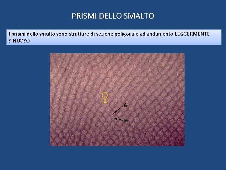 PRISMI DELLO SMALTO I prismi dello smalto sono strutture di sezione poligonale ad andamento PRISMI DELLO SMALTO I prismi dello smalto sono strutture di sezione poligonale ad andamento