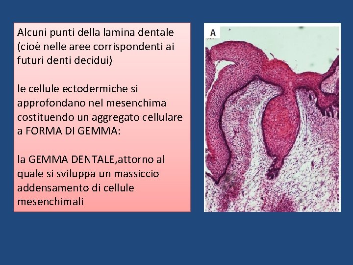 Alcuni punti della lamina dentale (cioè nelle aree corrispondenti ai futuri denti decidui) le Alcuni punti della lamina dentale (cioè nelle aree corrispondenti ai futuri denti decidui) le
