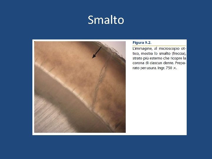 Smalto Smalto
