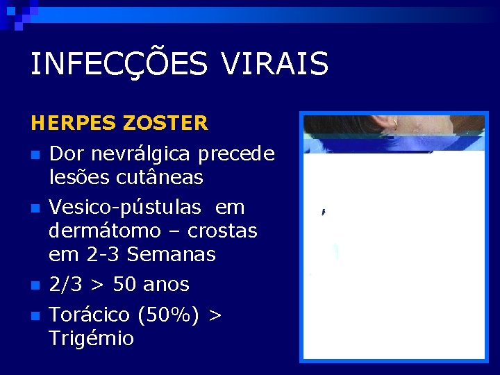 INFECÇÕES VIRAIS HERPES ZOSTER n Dor nevrálgica precede lesões cutâneas n Vesico-pústulas em dermátomo