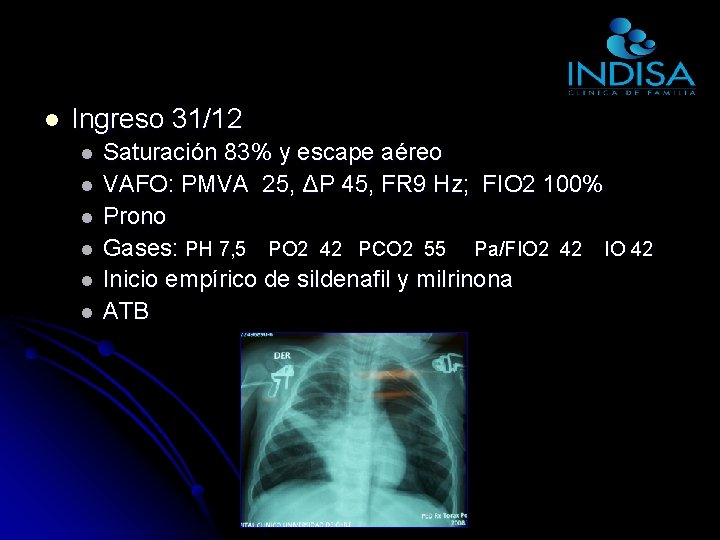 l Ingreso 31/12 l l l Saturación 83% y escape aéreo VAFO: PMVA 25, l Ingreso 31/12 l l l Saturación 83% y escape aéreo VAFO: PMVA 25,