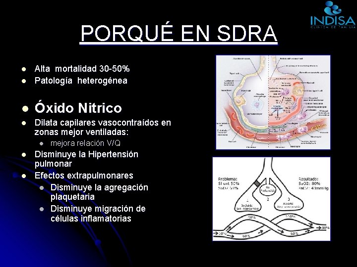 PORQUÉ EN SDRA l Alta mortalidad 30 -50% Patología heterogénea l Óxido Nitrico l