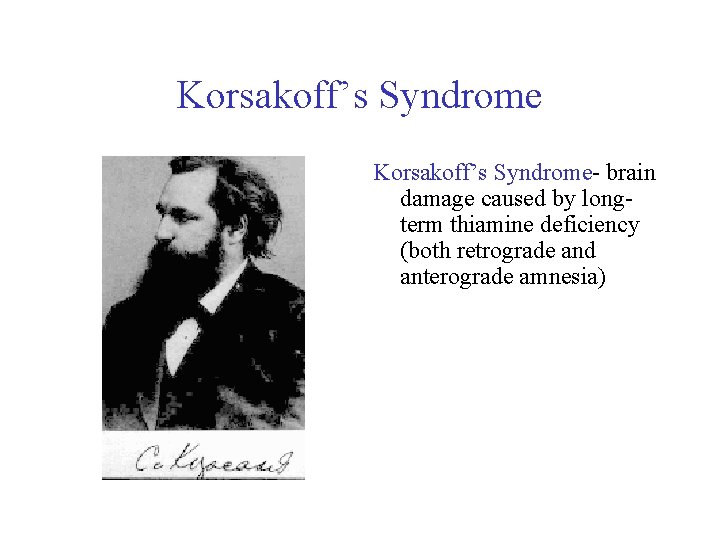 Korsakoff’s Syndrome- brain damage caused by longterm thiamine deficiency (both retrograde and anterograde amnesia)