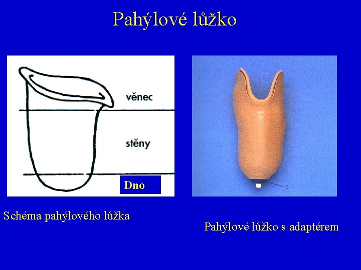 Pahýlové lůžko Dno Schéma pahýlového lůžka Pahýlové lůžko s adaptérem 