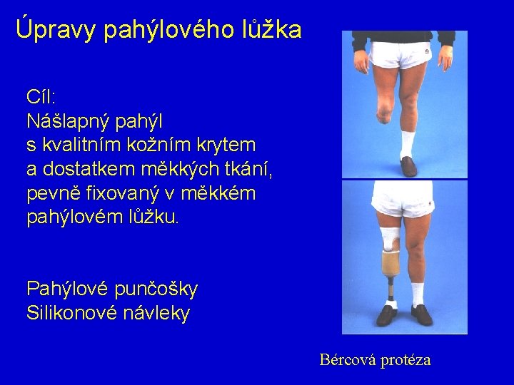 Úpravy pahýlového lůžka Cíl: Nášlapný pahýl s kvalitním kožním krytem a dostatkem měkkých tkání,