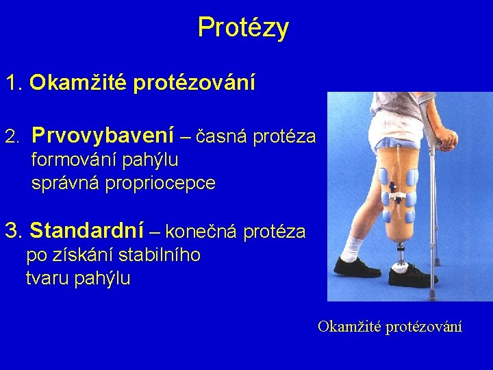 Protézy 1. Okamžité protézování 2. Prvovybavení – časná protéza formování pahýlu správná propriocepce 3.