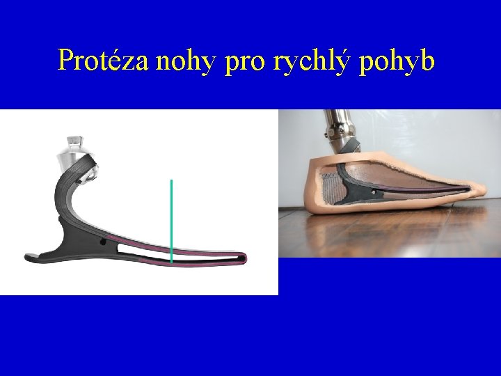 Protéza nohy pro rychlý pohyb 