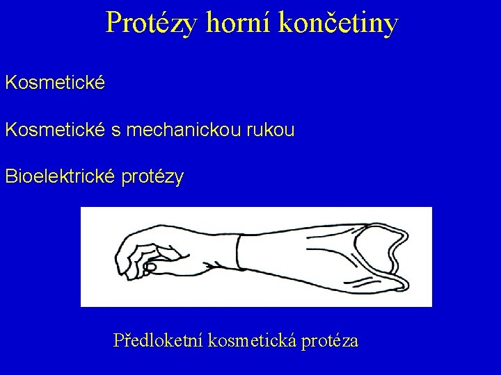 Protézy horní končetiny Kosmetické s mechanickou rukou Bioelektrické protézy Předloketní kosmetická protéza 