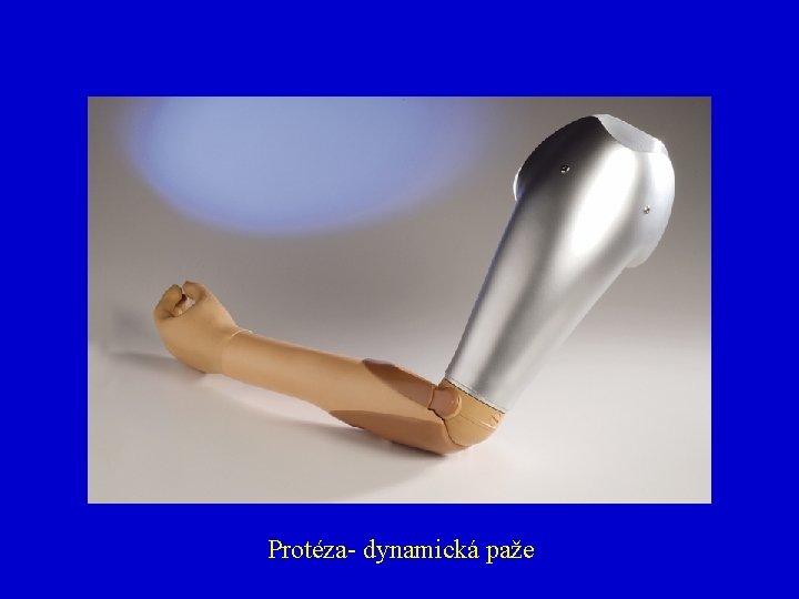 Protéza- dynamická paže 