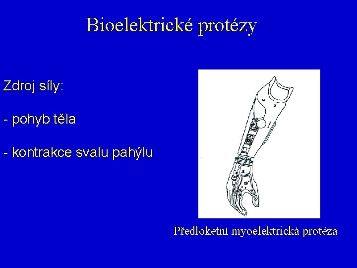 Bioelektrické protézy Zdroj síly: - pohyb těla - kontrakce svalu pahýlu Předloketní myoelektrická protéza