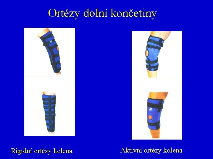 Ortézy dolní končetiny Rigidní ortézy kolena Aktivní ortézy kolena 