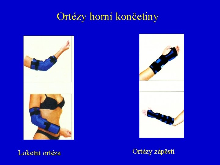 Ortézy horní končetiny Loketní ortéza Ortézy zápěstí 