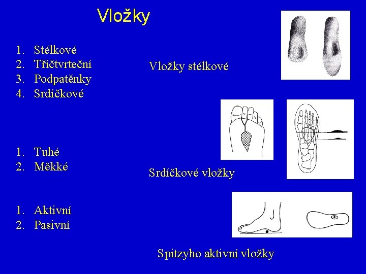 Vložky 1. 2. 3. 4. Stélkové Tříčtvrteční Podpatěnky Srdíčkové 1. Tuhé 2. Měkké Vložky