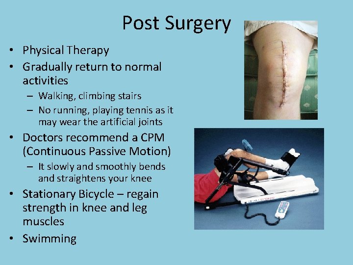 Post Surgery • Physical Therapy • Gradually return to normal activities – Walking, climbing