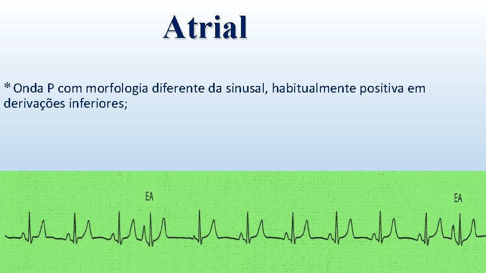 Atrial * Onda P com morfologia diferente da sinusal, habitualmente positiva em derivações inferiores;