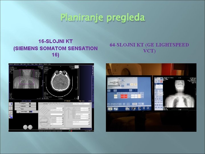 Planiranje pregleda 16 -SLOJNI KT (SIEMENS SOMATOM SENSATION 16) 64 -SLOJNI KT (GE LIGHTSPEED