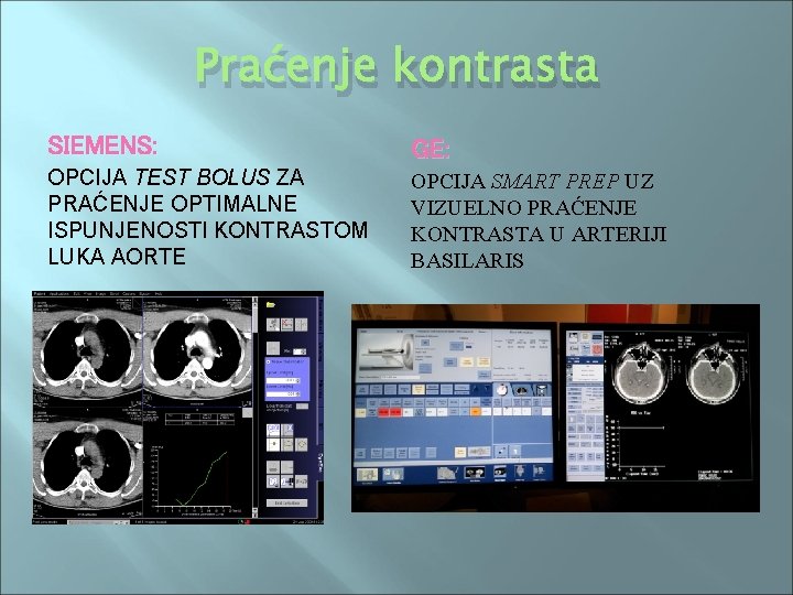 Praćenje kontrasta SIEMENS: GE: OPCIJA TEST BOLUS ZA PRAĆENJE OPTIMALNE ISPUNJENOSTI KONTRASTOM LUKA AORTE