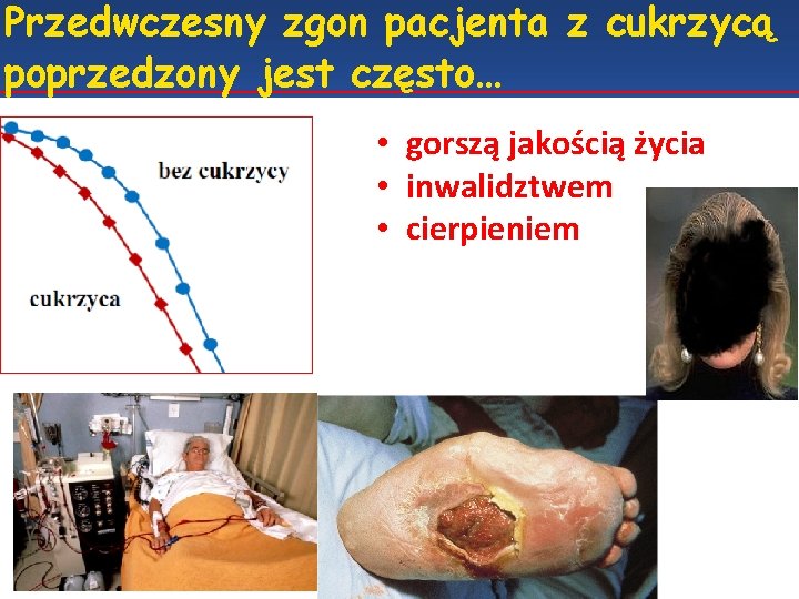 Przedwczesny zgon pacjenta z cukrzycą poprzedzony jest często… • gorszą jakością życia • inwalidztwem