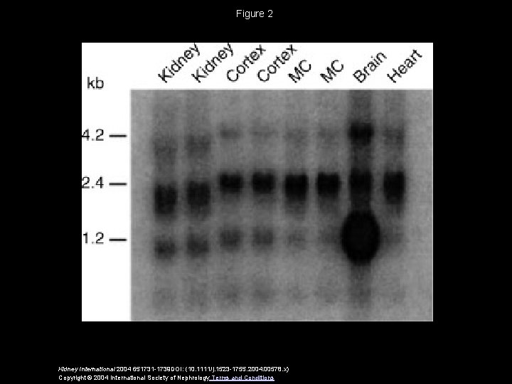 Figure 2 Kidney International 2004 651731 -1739 DOI: (10. 1111/j. 1523 -1755. 2004. 00578.