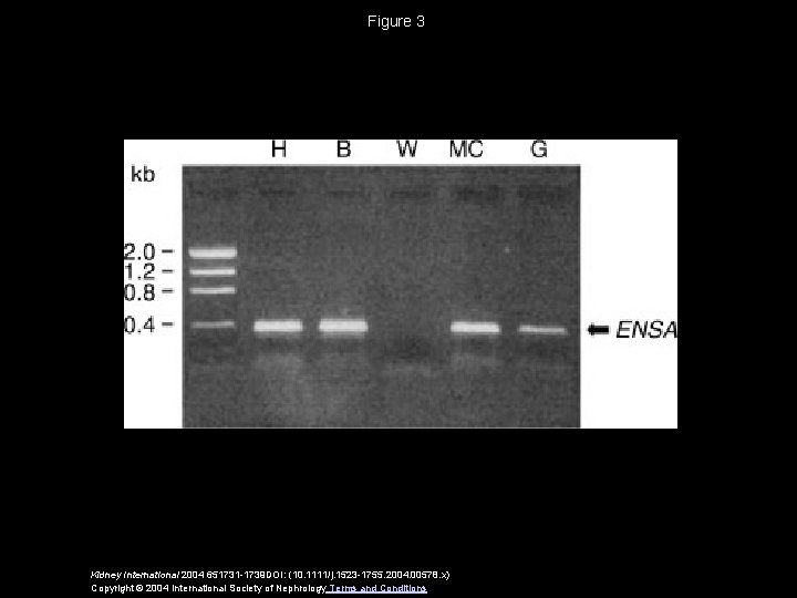 Figure 3 Kidney International 2004 651731 -1739 DOI: (10. 1111/j. 1523 -1755. 2004. 00578.