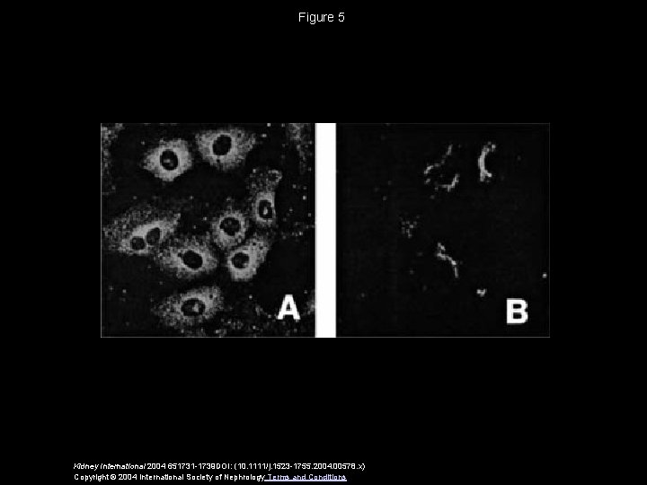 Figure 5 Kidney International 2004 651731 -1739 DOI: (10. 1111/j. 1523 -1755. 2004. 00578.