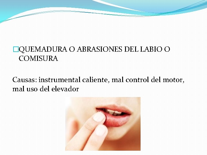 �QUEMADURA O ABRASIONES DEL LABIO O COMISURA Causas: instrumental caliente, mal control del motor,