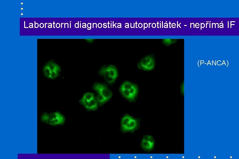 Laboratorní diagnostika autoprotilátek - nepřímá IF (P-ANCA) 