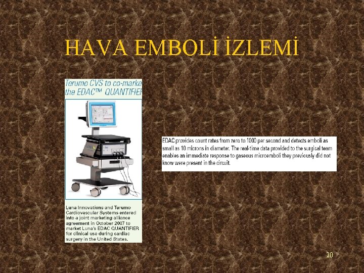 HAVA EMBOLİ İZLEMİ 20 