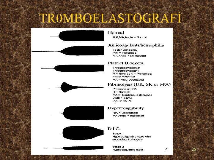 TR 0 MBOELASTOGRAFİ 26 