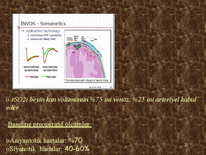 o r. SO 2 i beyin kan volümünün %75 ini venöz, %25 ini arteriyel