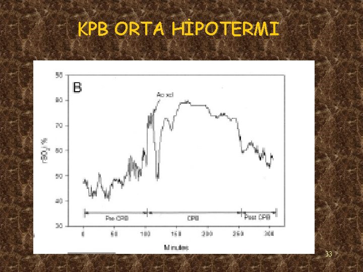 KPB ORTA HİPOTERMI 33 