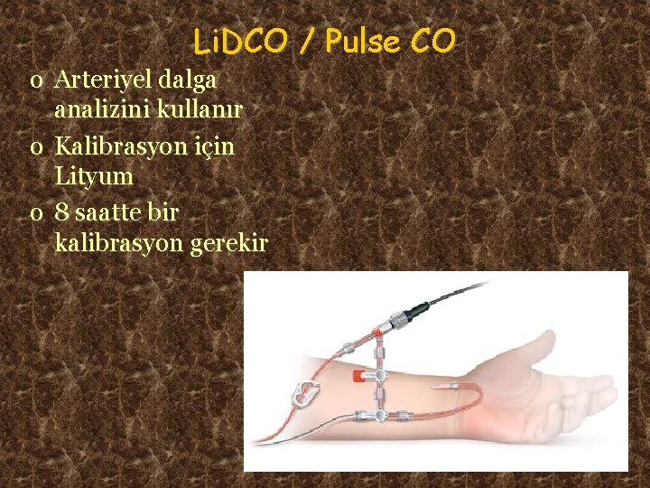 Li. DCO / Pulse CO o Arteriyel dalga analizini kullanır o Kalibrasyon için Lityum