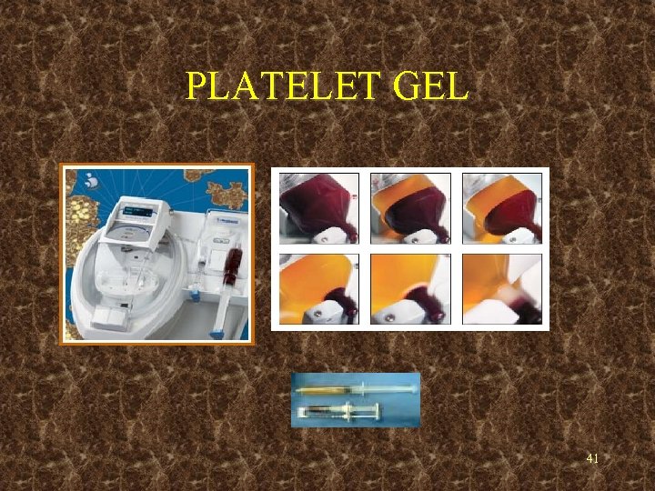 PLATELET GEL 41 