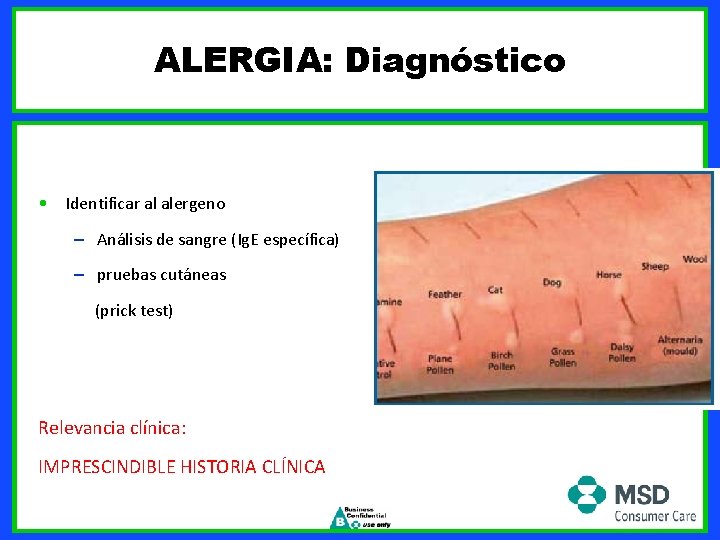 ALERGIA: Diagnóstico • Identificar al alergeno – Análisis de sangre (Ig. E específica) –