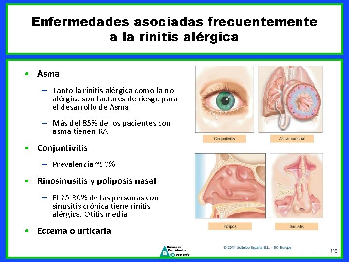 Enfermedades asociadas frecuentemente a la rinitis alérgica • Asma – Tanto la rinitis alérgica