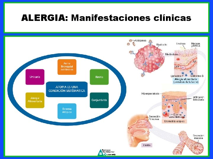 ALERGIA: Manifestaciones clínicas 